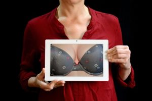 Breast implant cancer link underscores importance of long-term monitoring